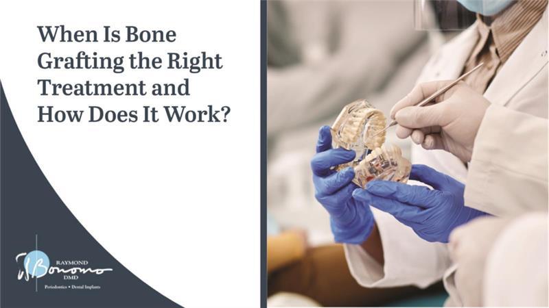 When Is BoneGrafting the Right Treatment and How Does It Work? 